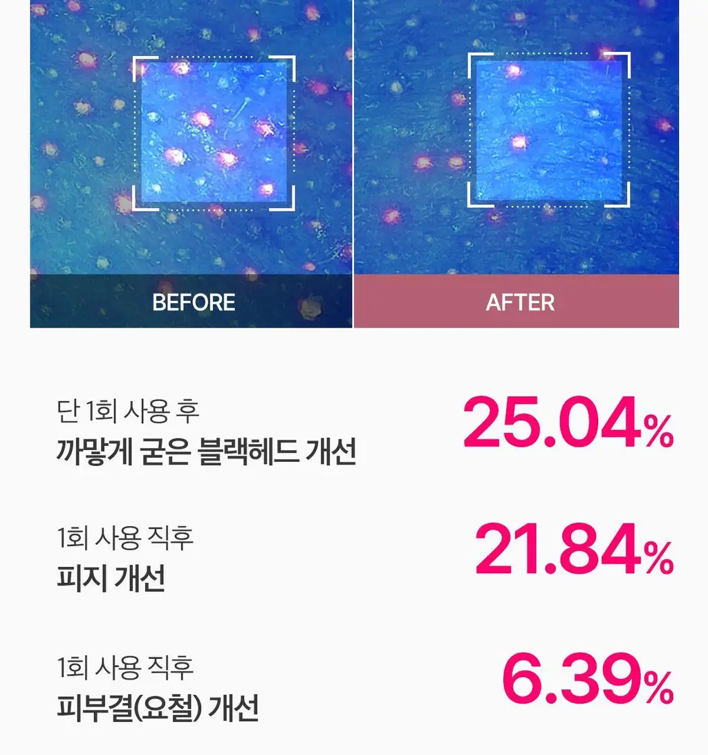 [피지뽑는] 에이프릴스킨 트라넥삼산 딥클렌저 120g 기획 (+15g 미니어처) 상세페이지 38